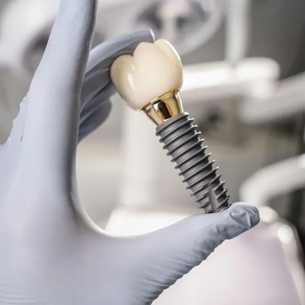 Mão com luva segura um implante dentário com coroa